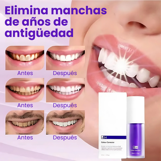 V34 Sérum Corrector Dental – Neutraliza el Amarillo y Realza tu Sonrisa